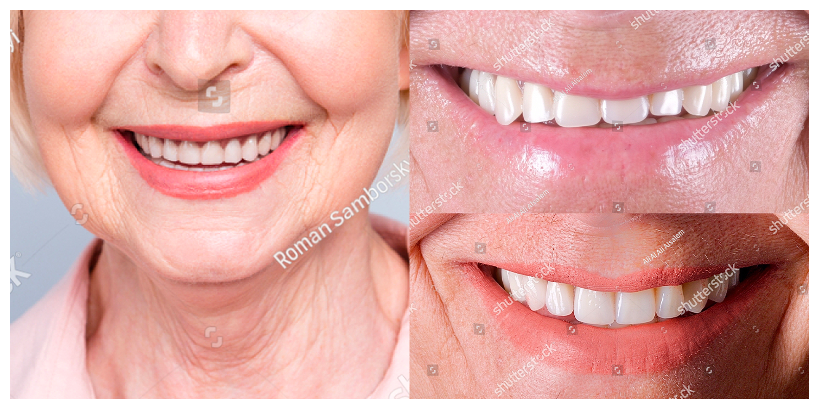 An elderly woman that had a smile makeover, smiling