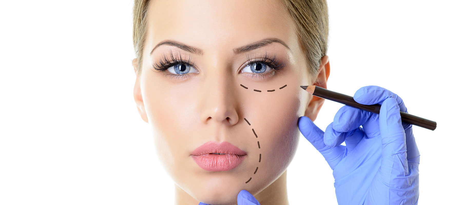 Woman's face is lined up for medical aesthetics operation
