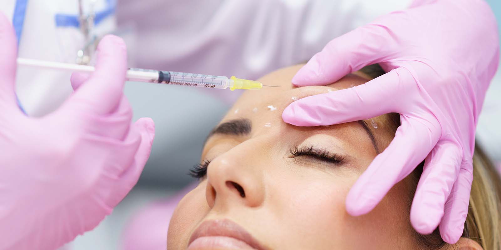 A women patient getting a french lift