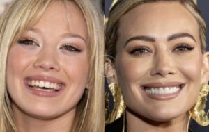 Familiar Smiles: Celebrities Who Got Their Teeth Done - FineUp Clinic