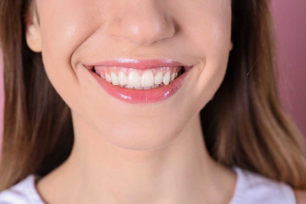 a patient that has gummy smile