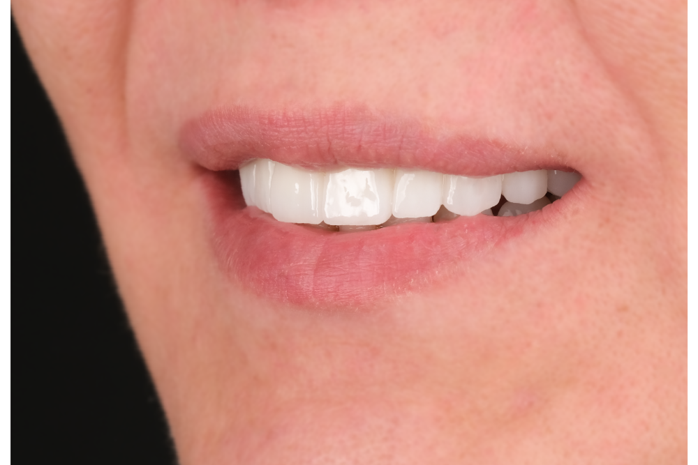 Close-up of patient 11-01